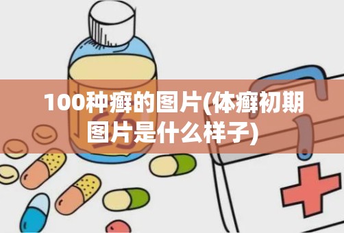 100种癣的图片(体癣初期图片是什么样子)