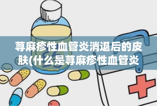 荨麻疹性血管炎消退后的皮肤(什么是荨麻疹性血管炎)