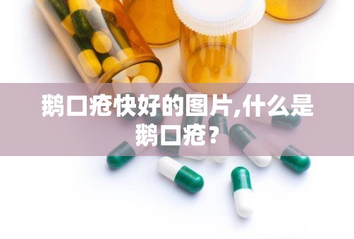 鹅口疮快好的图片,什么是鹅口疮？