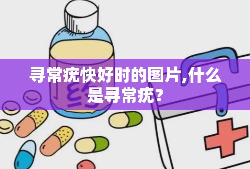 寻常疣快好时的图片,什么是寻常疣？