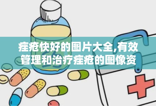 痤疮快好的图片大全,有效管理和治疗痤疮的图像资源汇总