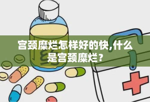 宫颈糜烂怎样好的快,什么是宫颈糜烂？