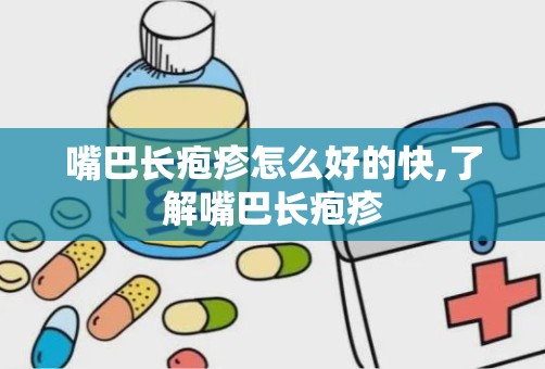 嘴巴长疱疹怎么好的快,了解嘴巴长疱疹