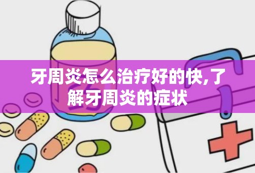 牙周炎怎么治疗好的快,了解牙周炎的症状