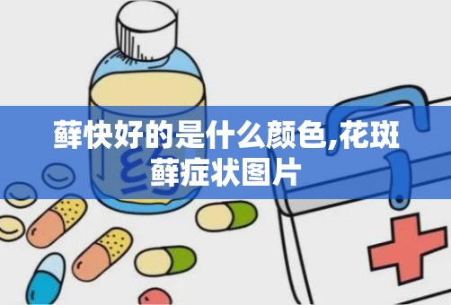 藓快好的是什么颜色,花斑藓症状图片