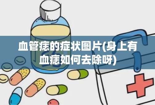 血管痣的症状图片(身上有血痣如何去除呀)